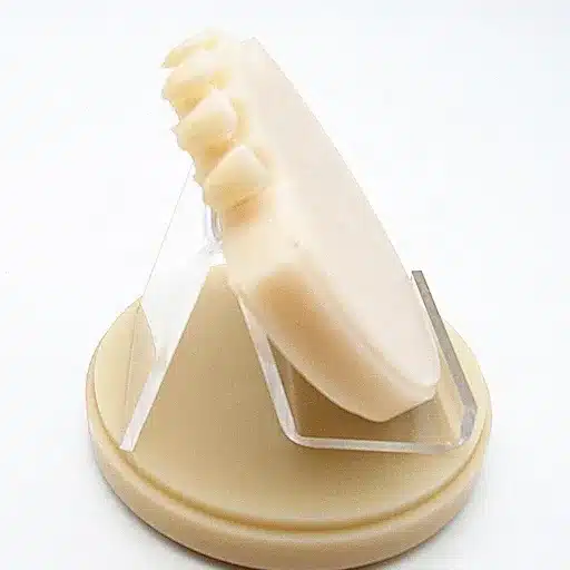 pmma dental