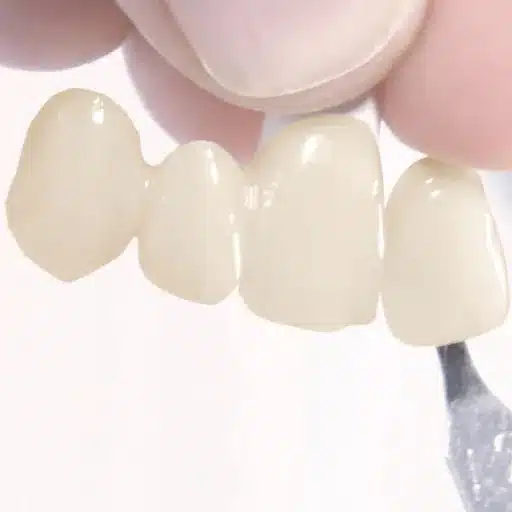 Introduction to PMMA in Dentistry